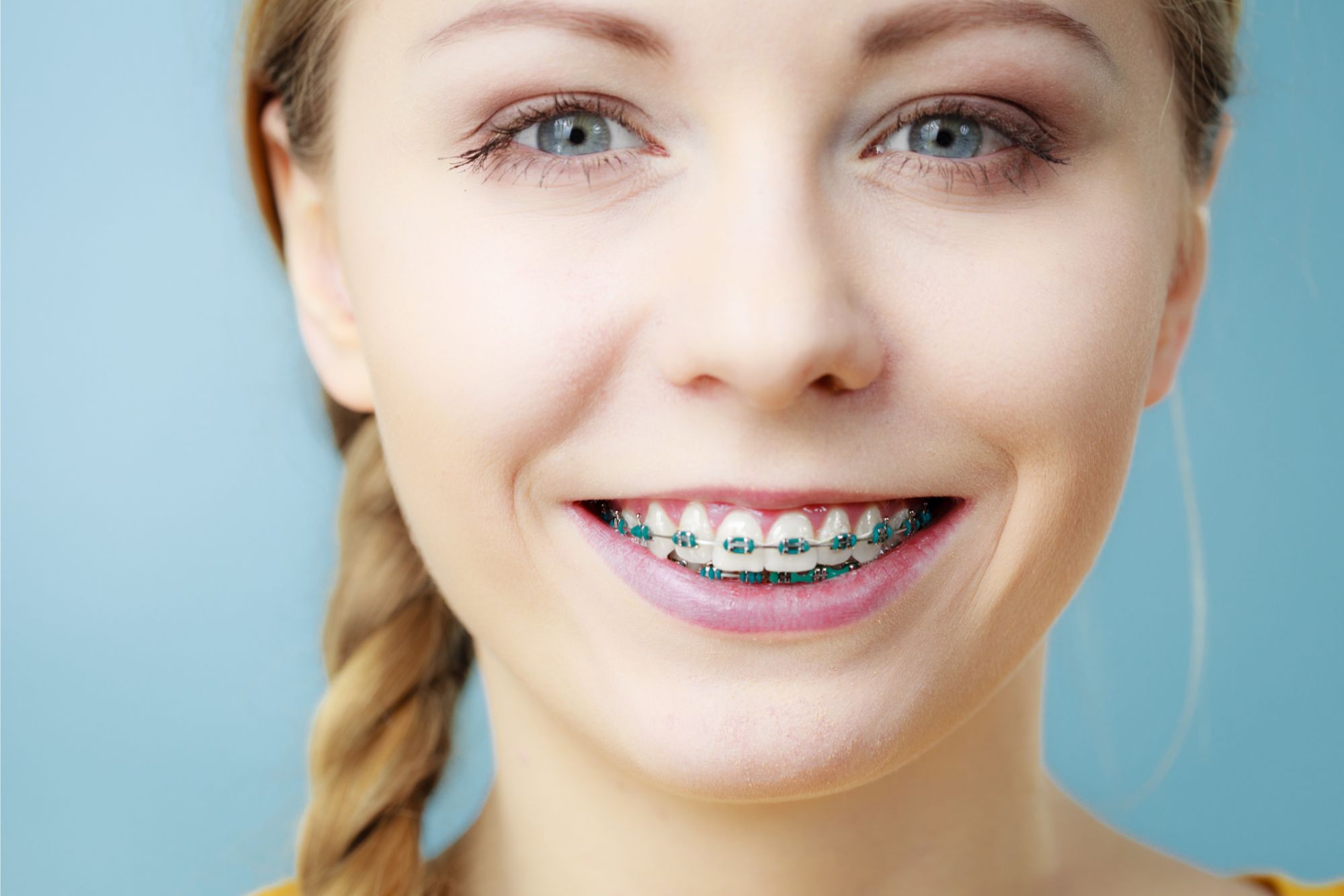 Orthodontics Treatment