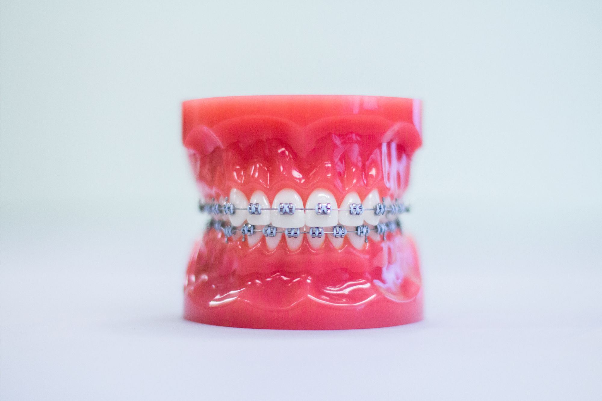 Orthodontics Treatment